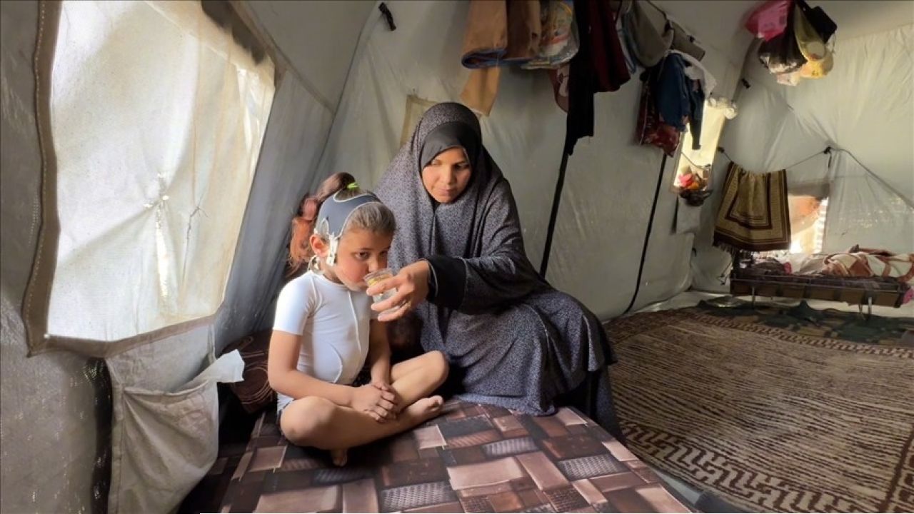 ইসরায়েলি হামলায় দগ্ধ ৫ বছরের রিতাল: চিকিৎসার অভাবে ধুঁকছে গাজার এক নিষ্পাপ শৈশব